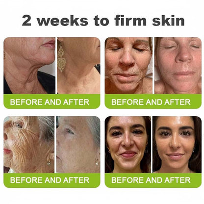 👨‍⚕️Made and shipped from the USA 💫LOVILDS® moringa & Vita-A Retinol Shot Wrinkle-Lift Tightening cream -Last Day Promotion 70% OFF