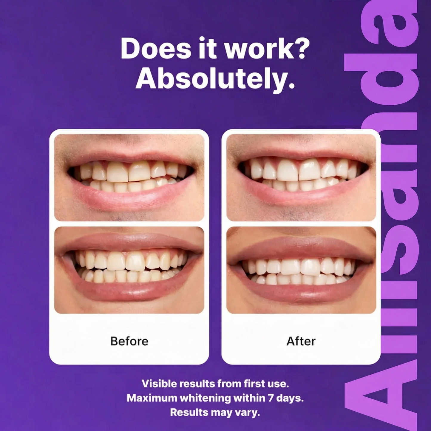 Alisanda Purple Teeth Whitening Strips