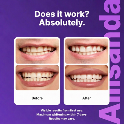 Alisanda Purple Teeth Whitening Strips