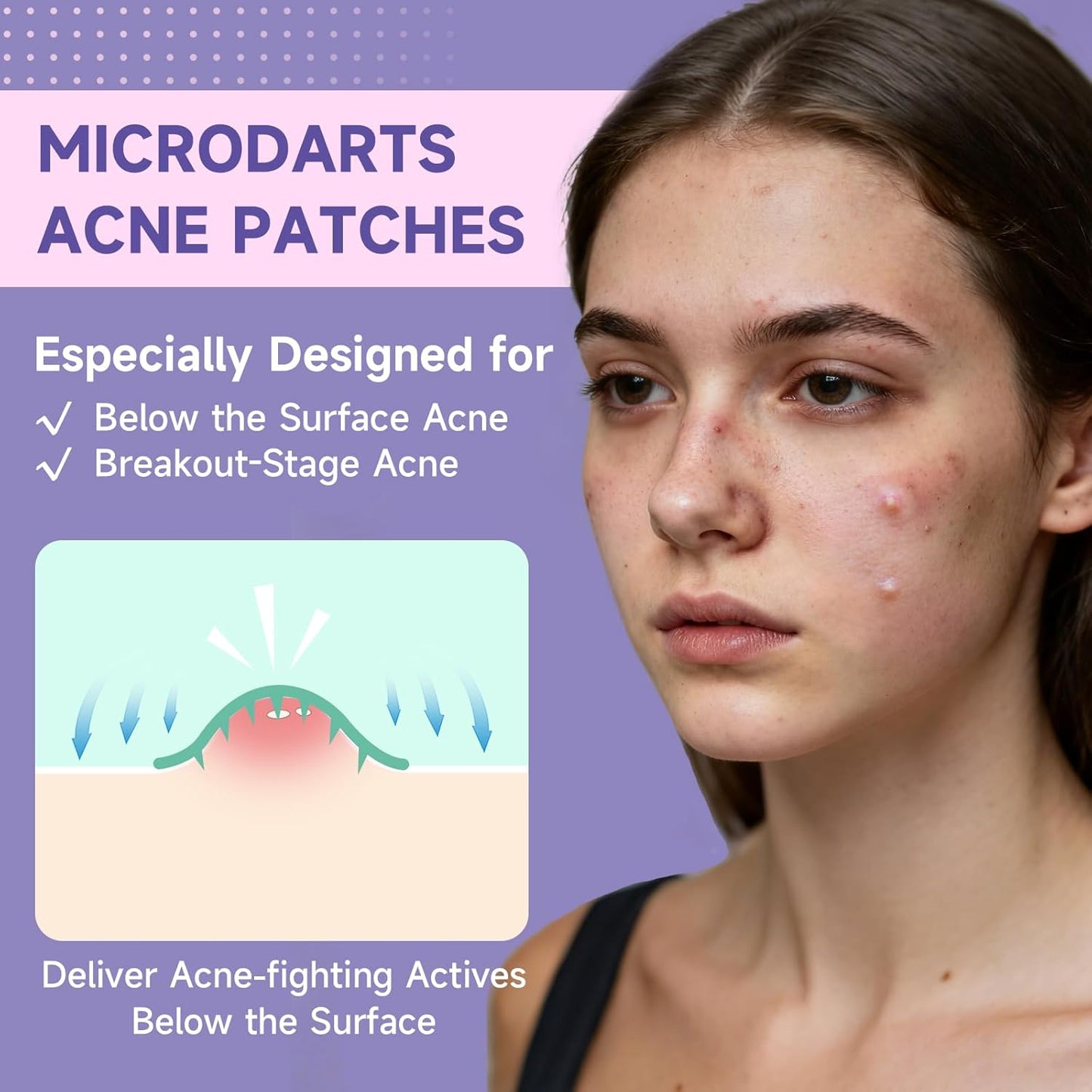 ✨ Alisanda® MicroDarts Skin Tag Patch – Fun Shapes Edition for Gentle Care (offer)