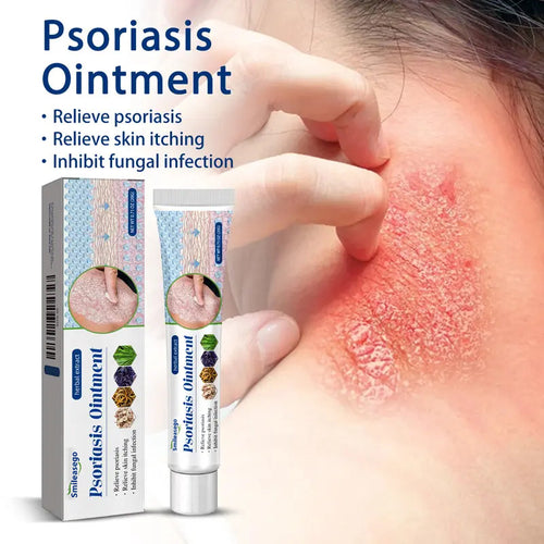 Psoriasis & Sensitive Skin Soothing Cream – Helps Calm Dry, Itchy Skin