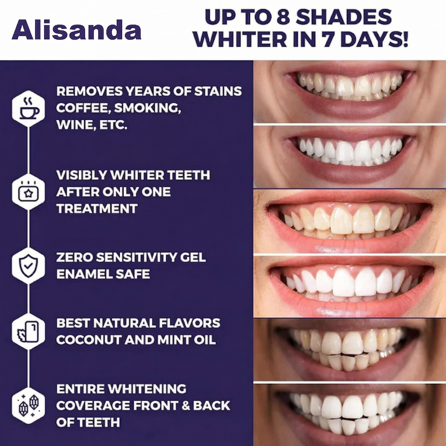 Alisanda Purple Teeth Whitening Strips
