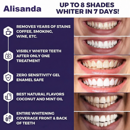 Alisanda Purple Teeth Whitening Strips