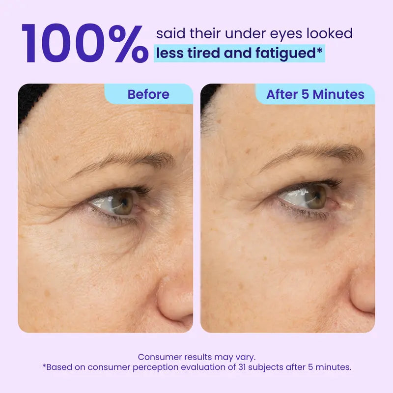 Lift, Smooth & Brighten Your Eyes in 60 Seconds — Reduce Bags, Wrinkles & Dark Circles Instantly