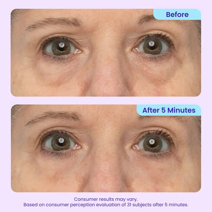 Lift, Smooth & Brighten Your Eyes in 60 Seconds — Reduce Bags, Wrinkles & Dark Circles Instantly