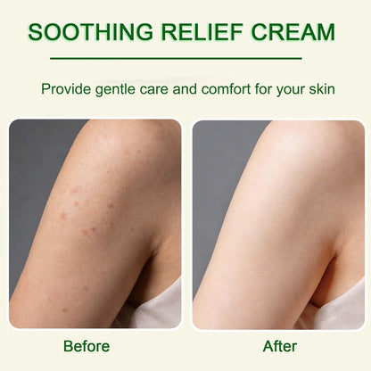 🌿Herbal Soothing Cream – Gentle Daily Moisturizer for Sensitive & Irritated Skin