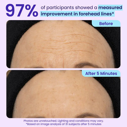 Lift, Smooth & Brighten Your Eyes in 60 Seconds — Reduce Bags, Wrinkles & Dark Circles Instantly