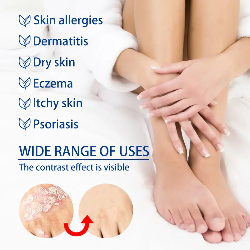 Psoriasis & Sensitive Skin Soothing Cream – Helps Calm Dry, Itchy Skin