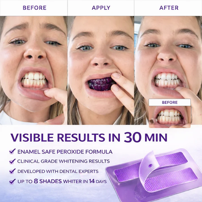 Alisanda Purple Teeth Whitening Strips
