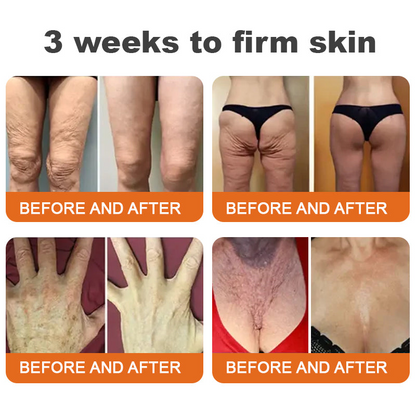 ✨✨Made and Shipped from US🇬🇧LOVILDS®Tightening Burn Gold Massage Cream(⏳LAST DAY 70% OFF)✨
